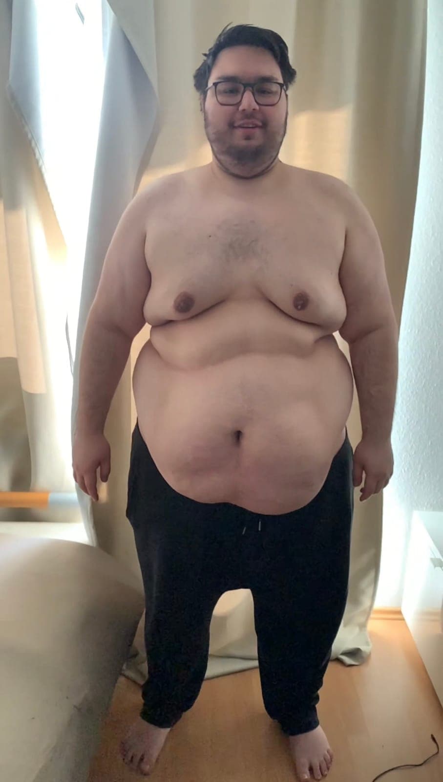 Dennis vor der Abnahme – Ganzkörperfoto mit starkem Übergewicht